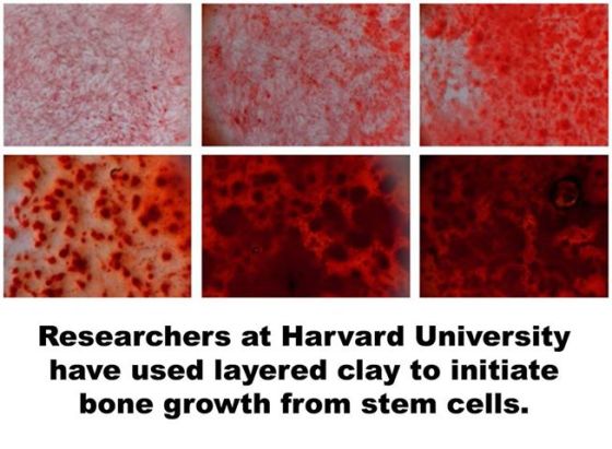 More Stem Cells- growth of bones cells from stem cells